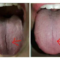 سونوگرافی از بدن