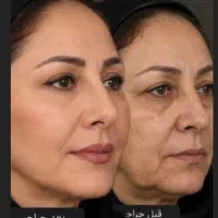 دکتر نسرین سیار جراح متخصص گوش حلق بینی