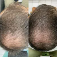 تضمینیی موهاات درمیاد