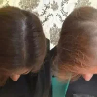 فول تراکم تا ابد