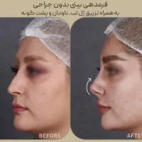 پکیجYongFaceصورت چشم پلک ژل لب غبغب بینی ابروآف۶۰٪