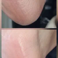 خدمات ناخن و کفسابی پا،تخفیف ویژه