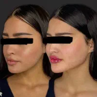 کیلینیک زیبایی