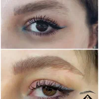 میکروبلیدینگ،فیبروز،شیدینگ لب،آموزش.آف ویژه