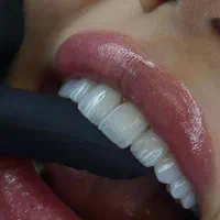 ۵۰٪ تخفیف خدمات دندان‌پزشکی،فقط برای مدت محدود
