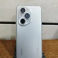 گوشی آنر 400 پرو نسخه گلوبال