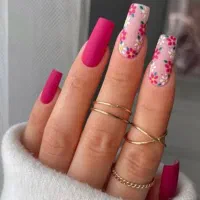 تخفیف ویژه کاشت به مدت یه هفته400ترمیم350با دوطرح