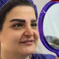 کاشت ابرو تضمینی ۱۵ میلیون