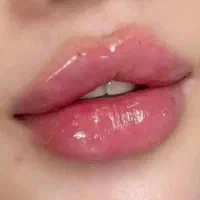 جشنواره فیلر/ژل(فقط850 تاشنبه)درمطب/پزشک تهرانی
