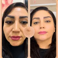 کلینیک زیبایی رز سفید 30 % off تابستانه