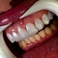 خدمات زیبایی و درمانی دندان