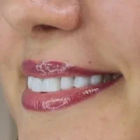 اعطای نمایندگی رسمی طلایی شو...کل ایران