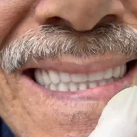 لابراتوار و دندانسازی و دندان مصنوعی