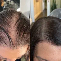 گیاهی بدون عوارض