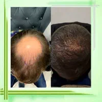 وقتشه که توهم ریشو شی