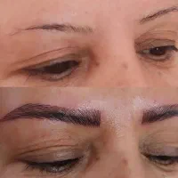 میکروبلیدینگ ابرو،فیبروز،میکروپیگمنتیشن