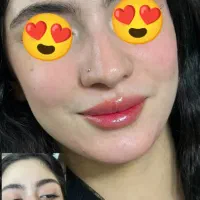 خدمات ژل،بوتاکس،مزو وپی ارپی،کاشت مووابرو،ساکشن