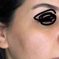 کرم سفیدکننده