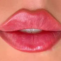 تزریق ژل وپی ارپی