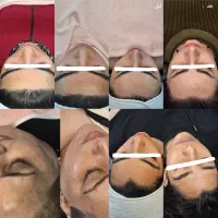 فیشال و پاکسازی صورت ، تتو بدن (بانوان)