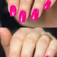 ناخن