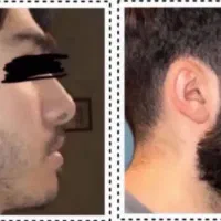 ریشاتو استایل کن
