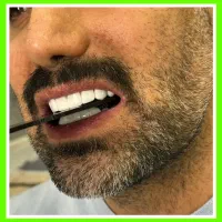 دندانپزشکی/کامپوزیت/عصبکشی/ترمیم/پالیش جرمگیری