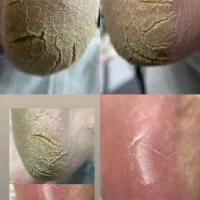 پدیکور تخصصی دلارا