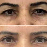 مژده بلفا با قیمت باورنکردنی فقط تا اخر اردیبهشت