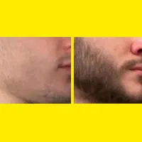 رازِ پُرپشتیِ حرفه‌ای‌ها