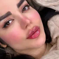 بوتاکس و فیلر قیمت قبل