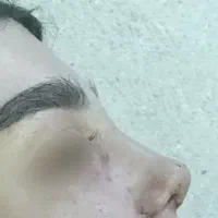 بینی|خدمات زیبایی و سلامت|دهدشت, |دیوار