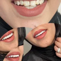 خدمات‌ زیبایی کامپوزیت