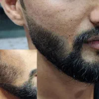 این اقدام اخریشه