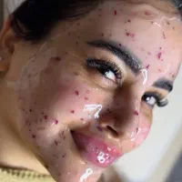 فیشیال/بوتاکس/مزوتراپی/برداشت خال
