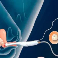 فروش سه عدد جنین ازمایشگاهی با کیفیت عالی