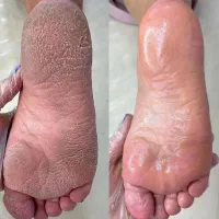 خدمات و آموزش تخصصی پدیکور واسپا(بانوان)