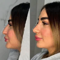 تقویت و رشد مو/لیفت بینی/ درمان واریس
