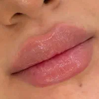 مدل برای ژل لب فقط هزینه مواد