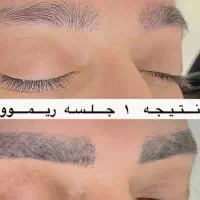 ریموو تک جلسه ای