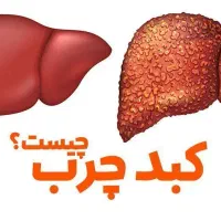 بهبود کبدچرب صدرصد تضمینی