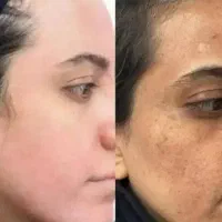 صورت|خدمات زیبایی و سلامت|دلند, |دیوار