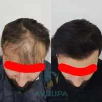 واقعی درمانت میکنم