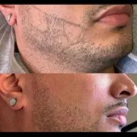 نتیجه گرفتن شرطه