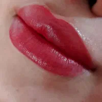 شید لب و رفع کبودی صدرا، فاز ۱، بلوار زاگرس