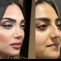 عمل بینی با پزشک ENT   و متخصص گوش و حلق و بینی