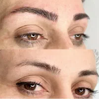 میکروبلیدینگ ابرو