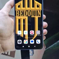 گوشی شیائومی Redmi Note 13 4G گلوبال با لوازم کامل