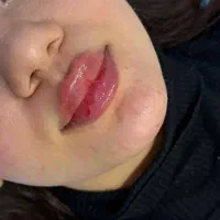 ژل،فول فیس،بوتاکس پیشانی،زیر بغل،پیرسینگ بدن