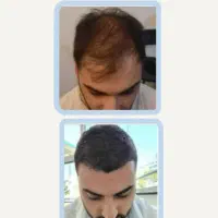 بپا سرت خالی نشه